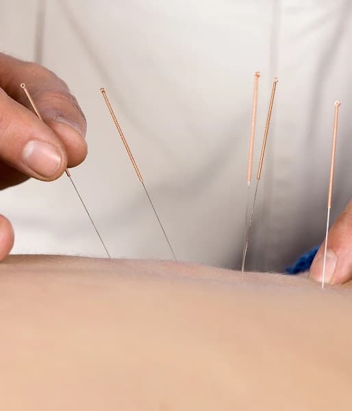Delaware Acupuncture & Wellness