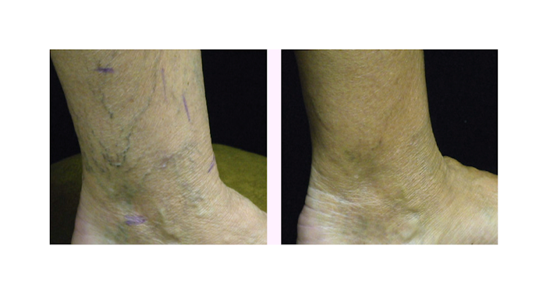 Cosmetic Laser Institute: Anthony Mamari MD